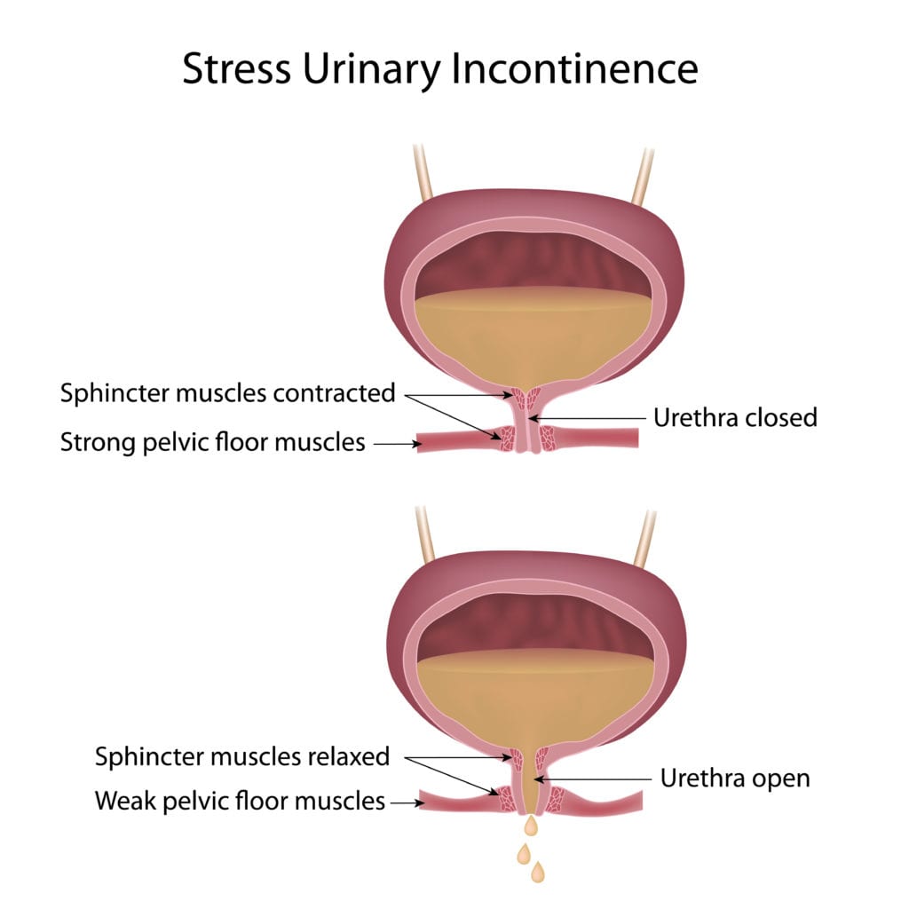 Bladder Leakage During and After Pregnancy, Oh My!