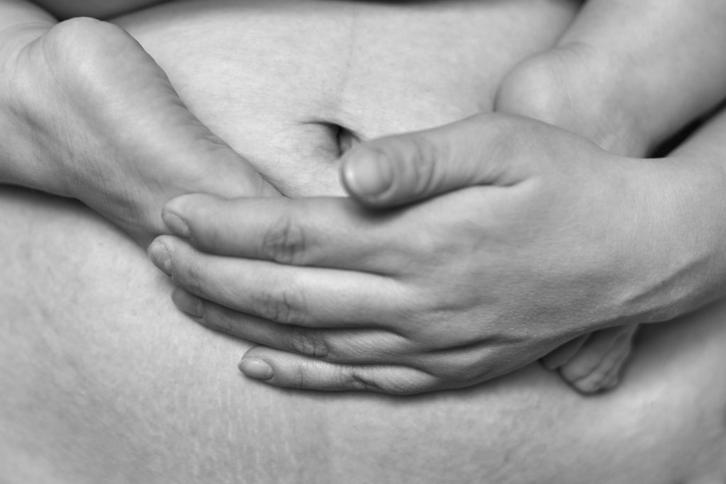 Stress Urinary Incontinence and Diastasis Recti