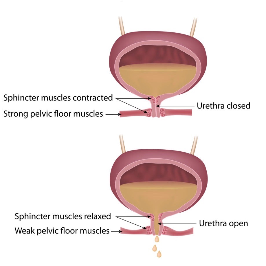 the-link-between-pelvic-floor-physical-therapy-and-urinary-incontinence